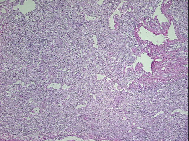 4x Image