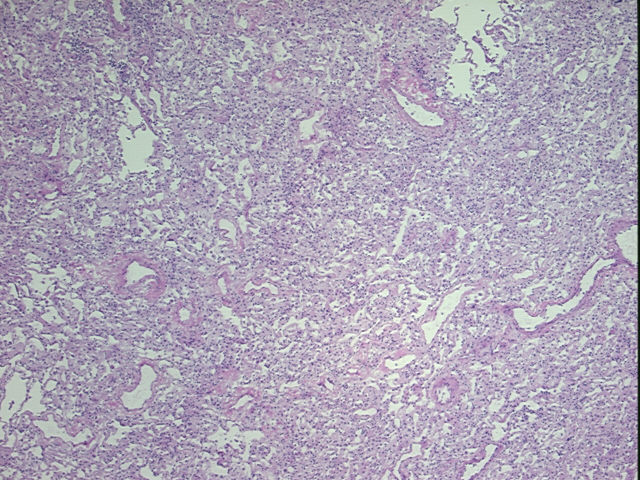 4x Image