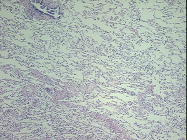 4x Image