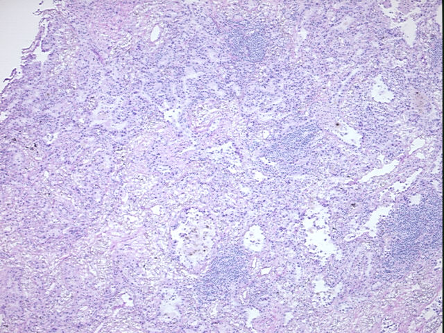 4x Image