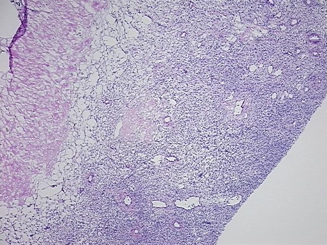 4x Image