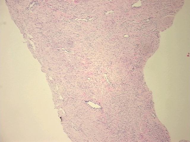 4x Image