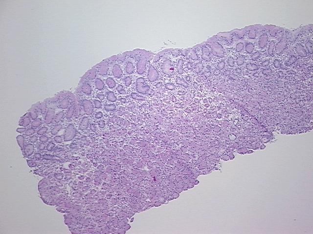 4x Image