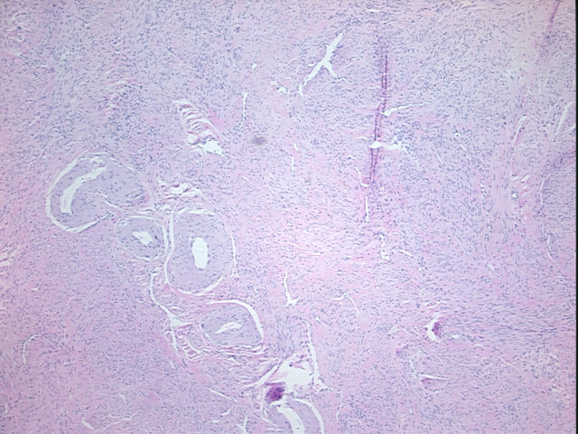 4x Image