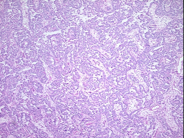 4x Image