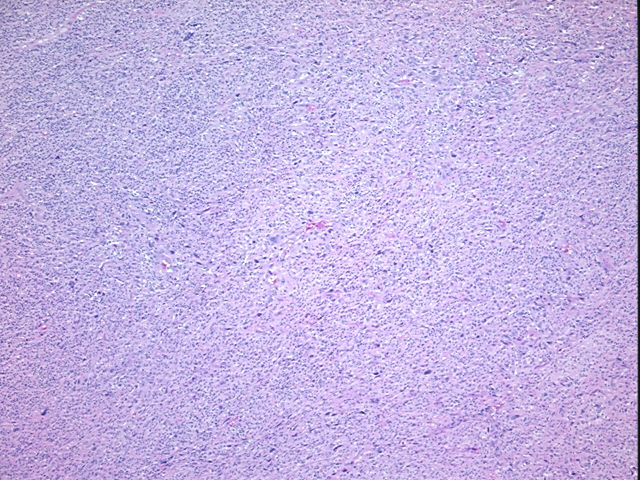 4x Image