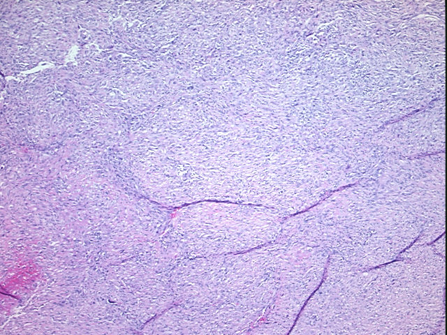 4x Image