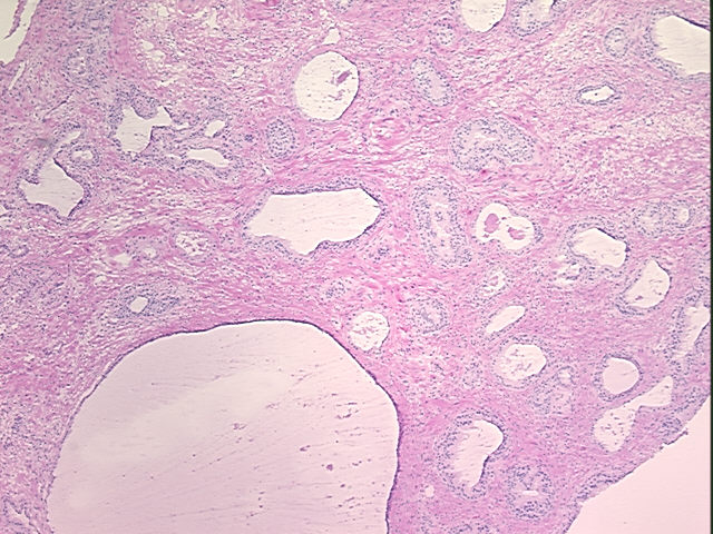 4x Image