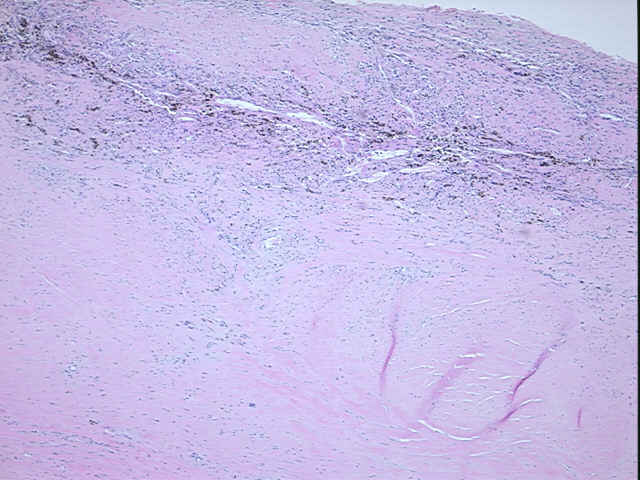 4x Image