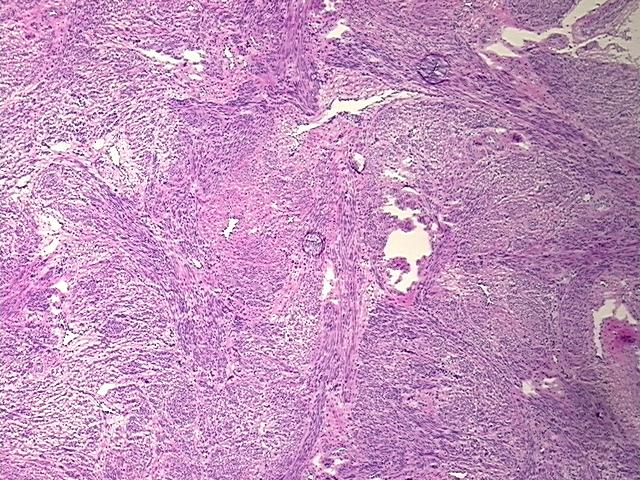 Frozen Tissue Sections, Myometrium