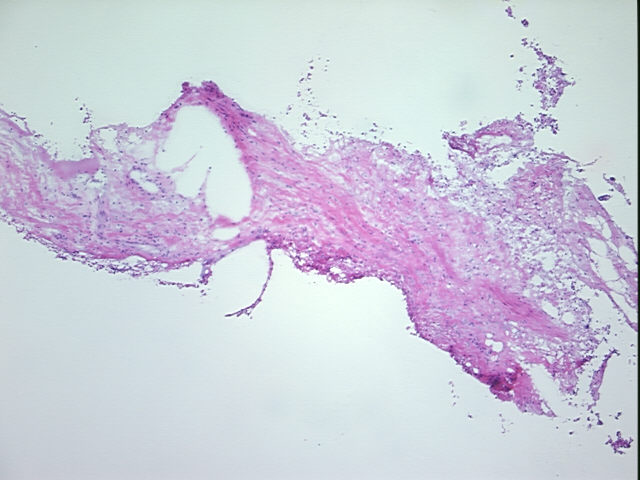 4x Image