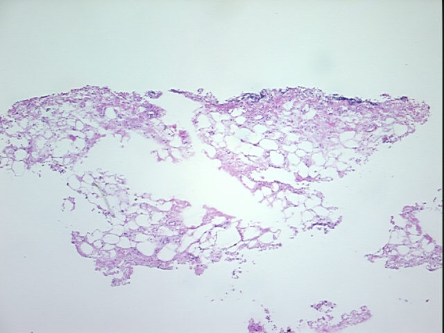 Frozen Tissue Sections, Omentum | OriGene Technologies Inc.