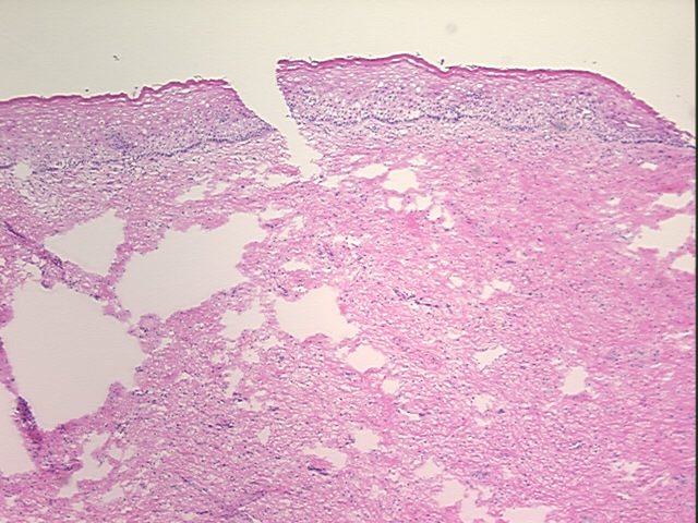 4x Image