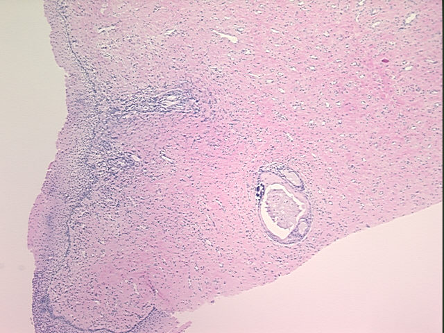 4x Image
