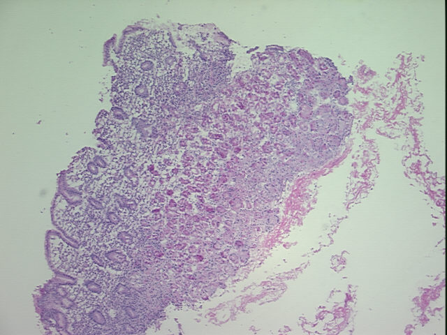 4x Image