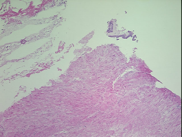 4x Image