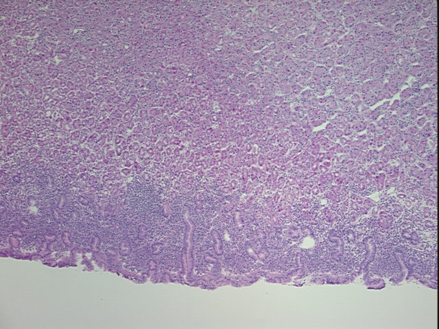 4x Image