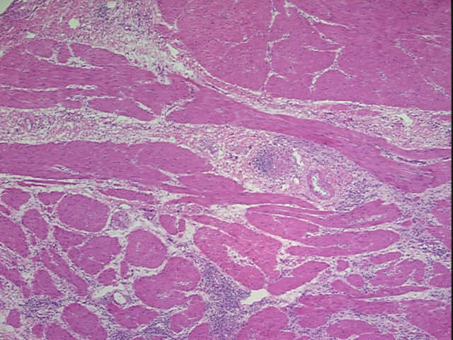 4x Image