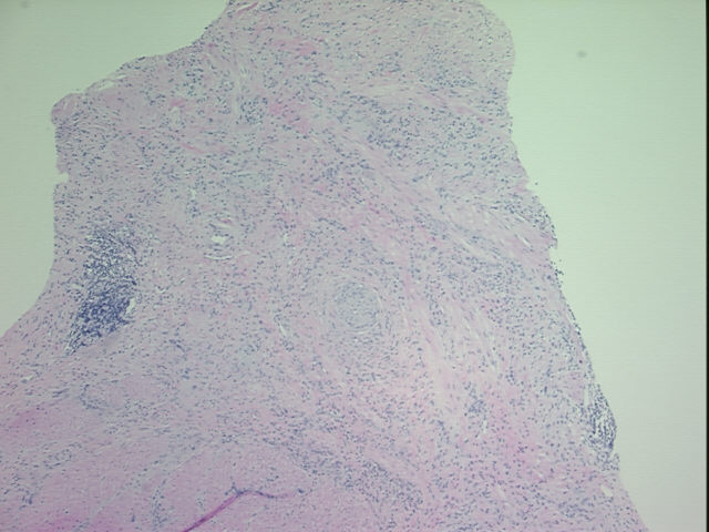 4x Image
