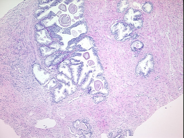 4x Image