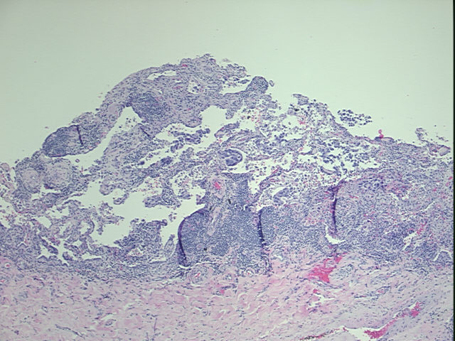 4x Image