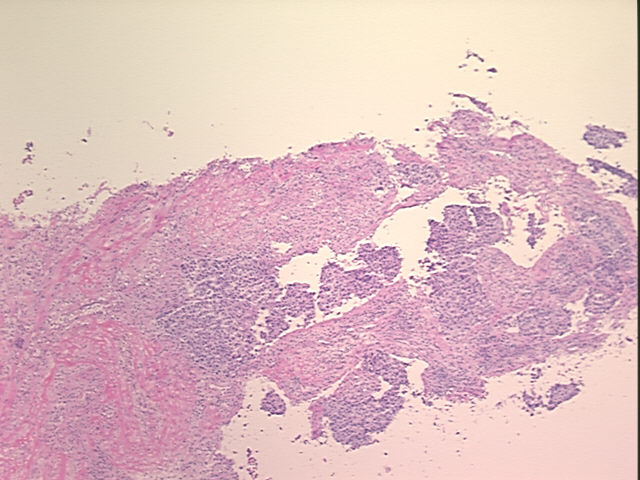 4x Image
