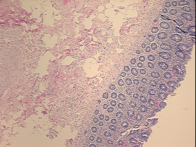 4x Image