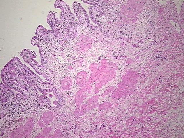 4x Image
