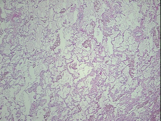 4x Image