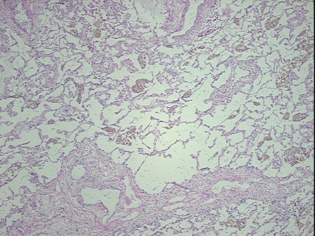 4x Image