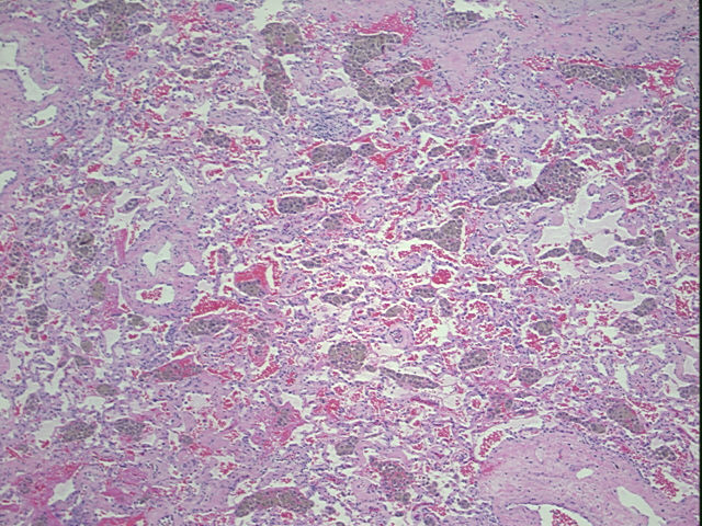 4x Image