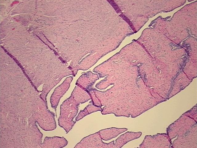 4x Image