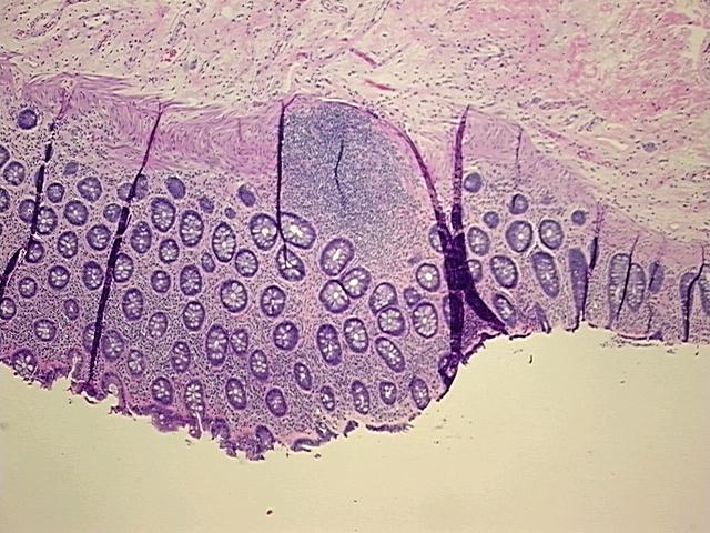 4x Image