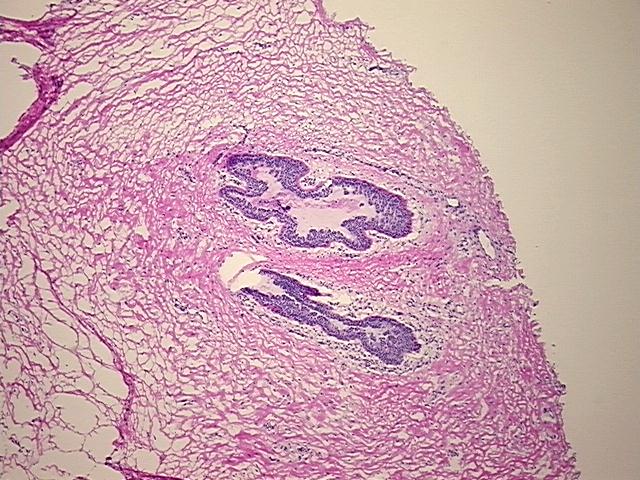 4x Image