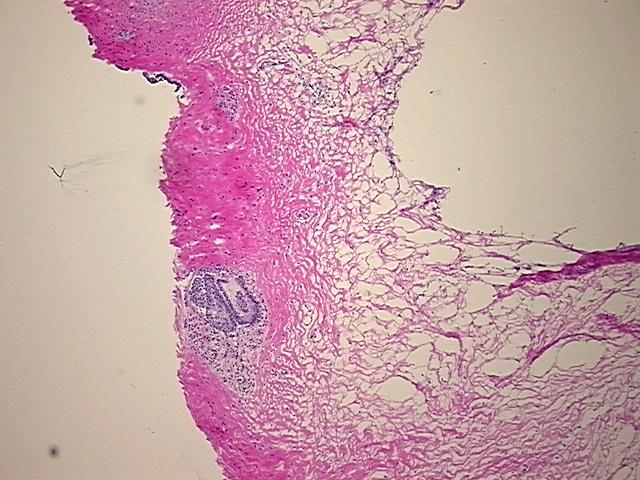 4x Image