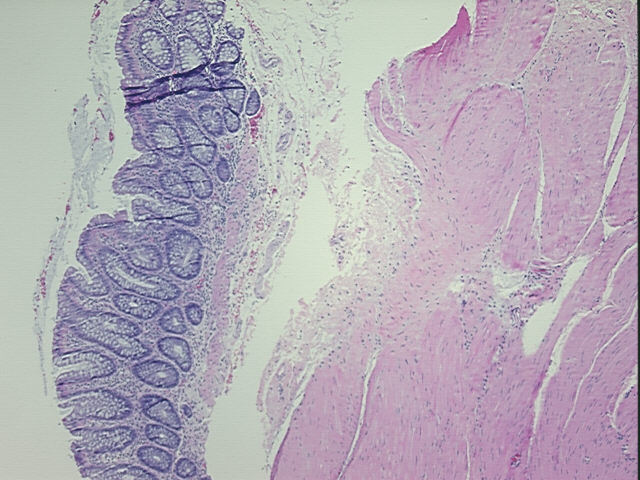 4x Image