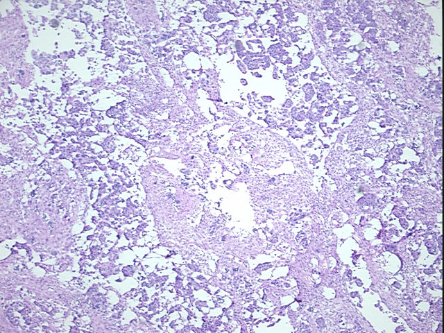 4x Image