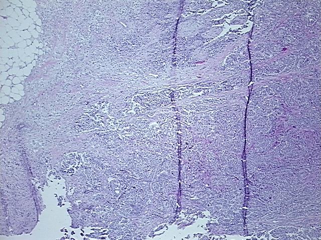 4x Image