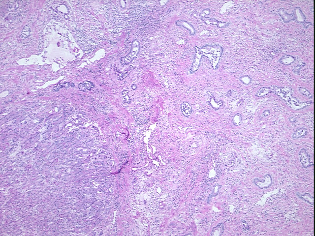 4x Image