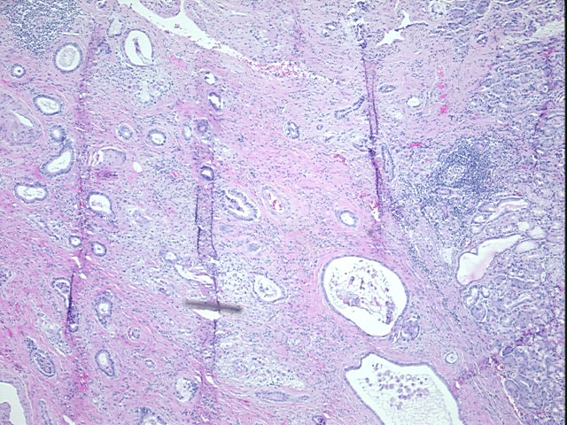 4x Image
