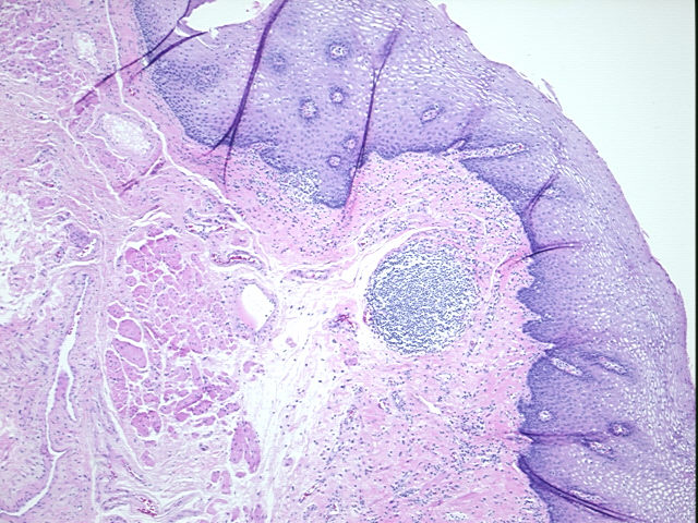 4x Image