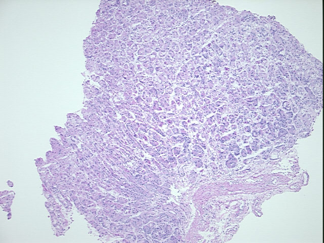 4x Image