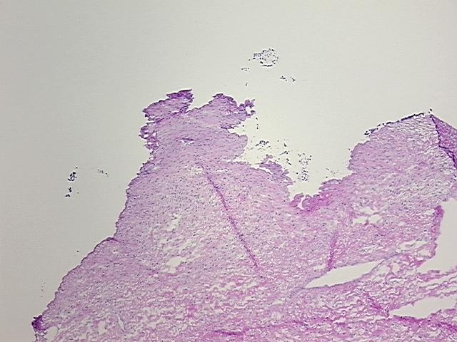 4x Image