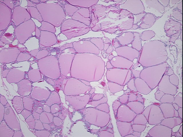 4x Image