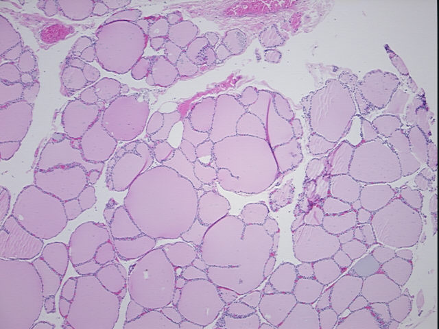 4x Image