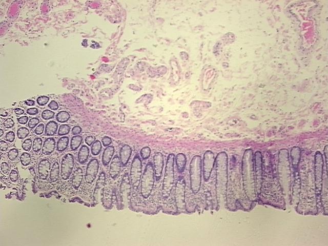 4x Image