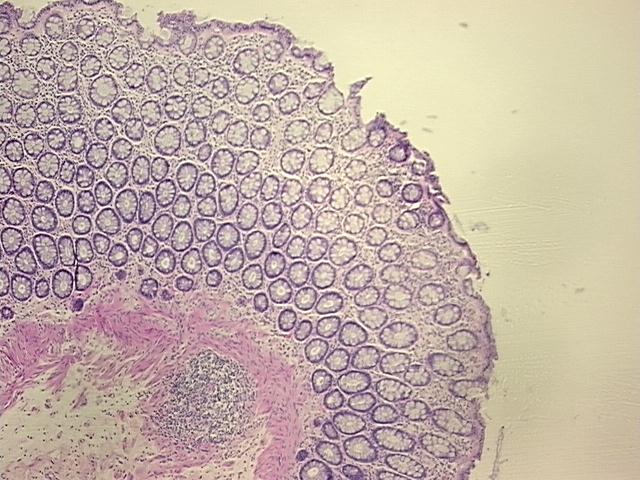 4x Image