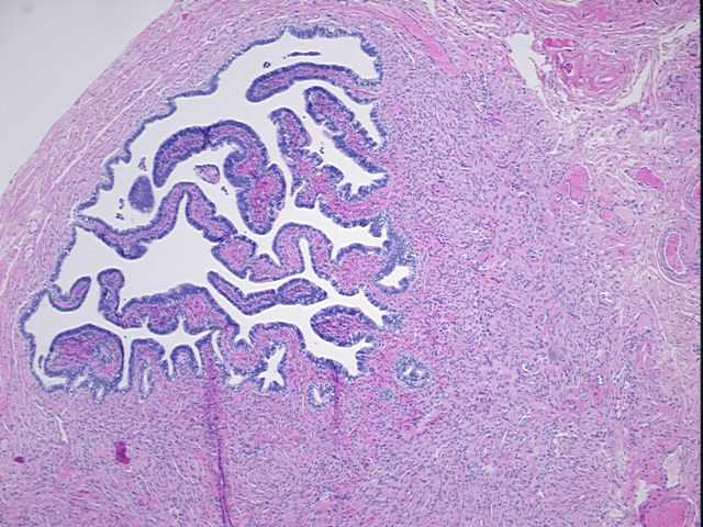 4x Image