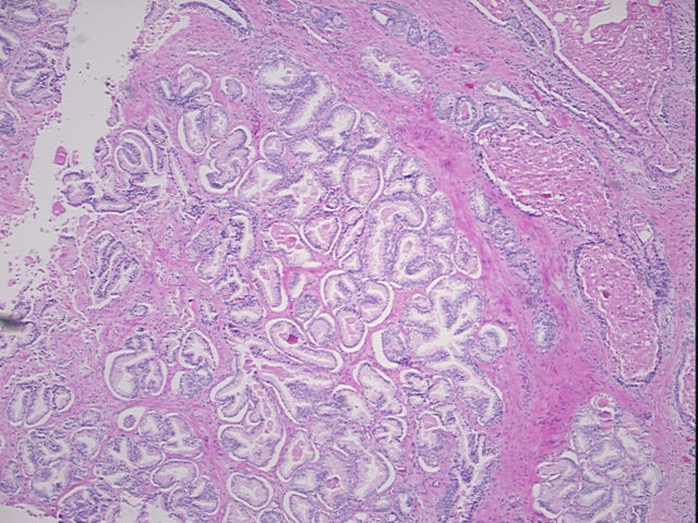 4x Image