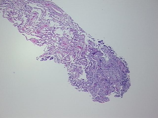 4x Image